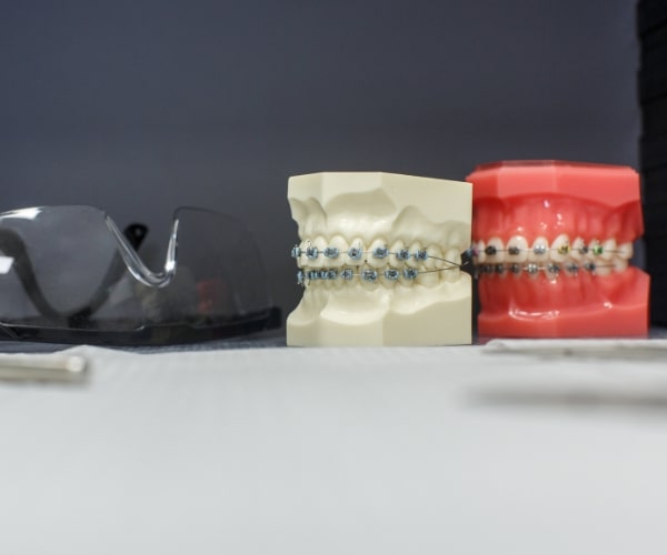 ortodoncja rzeszów